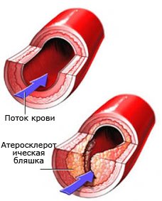 Фрукты и овощи - незаменимые помощники часть 1