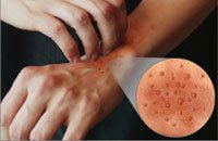 Ниацин (никотиновая кислита, витамин РР)