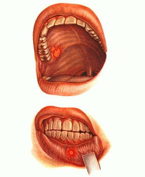 Рибофлавин (витамин В2)